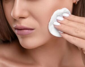 Chăm sóc da mụn đúng cách